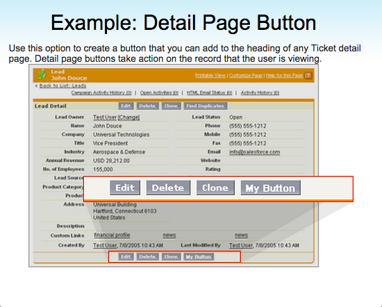 Detail Page Button